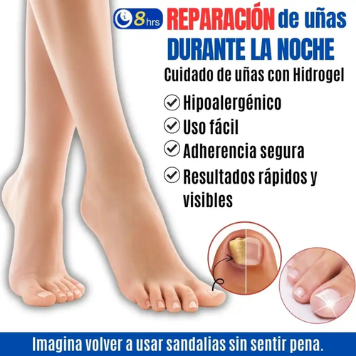 FUNGAL NAIL PATCHES — Elimina el hongo mientras duermes y vuelve a usar sandalias sin pena