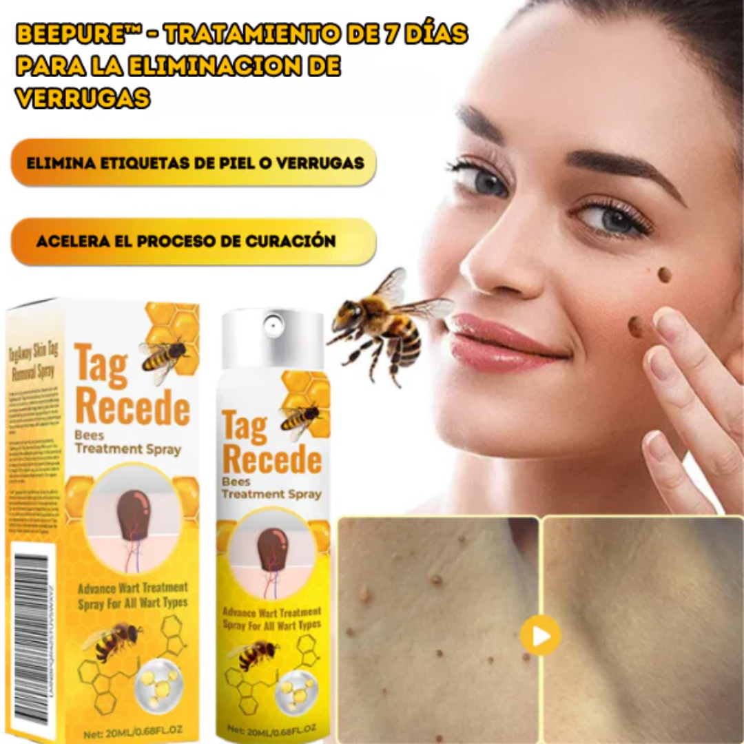 TAG RECEDE VENENO DE ABEJA — Elimina verrugas y etiquetas de piel con veneno de abeja en casa, sin dolor y sin cirugía