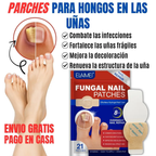 FUNGAL NAIL PATCHES — Elimina el hongo mientras duermes y vuelve a usar sandalias sin pena