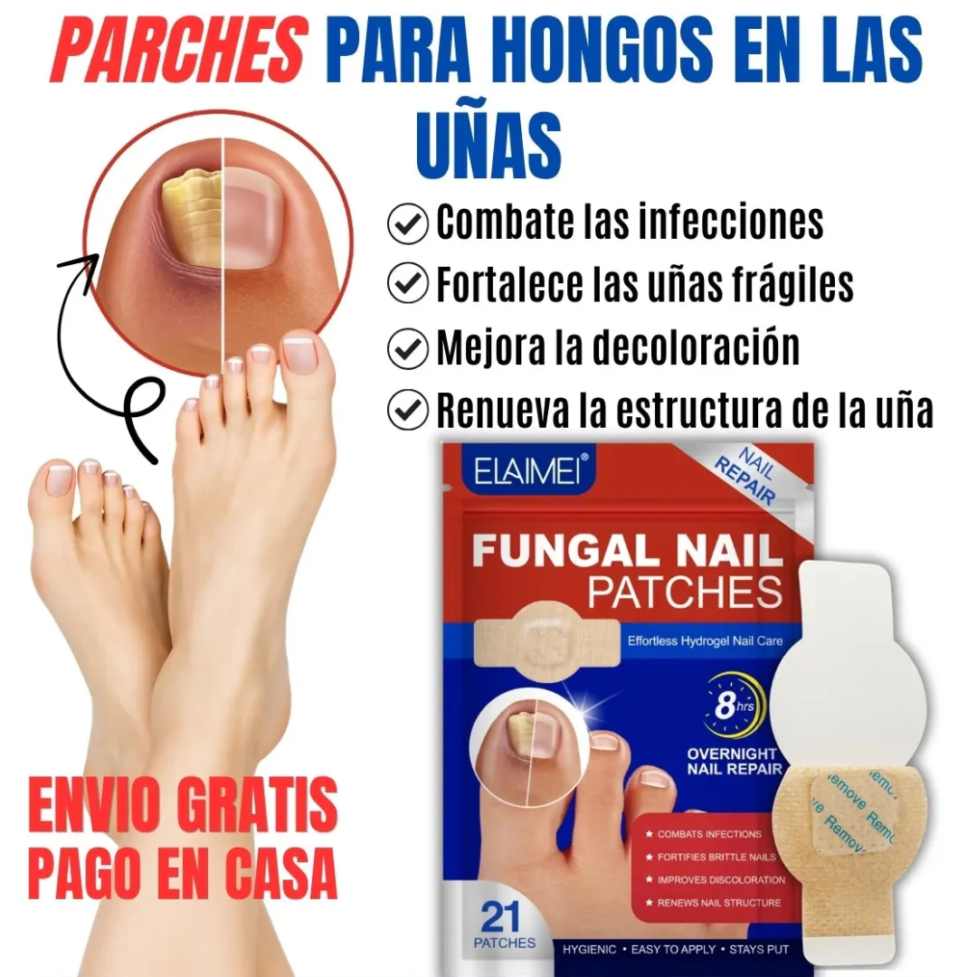 FUNGAL NAIL PATCHES — Elimina el hongo mientras duermes y vuelve a usar sandalias sin pena