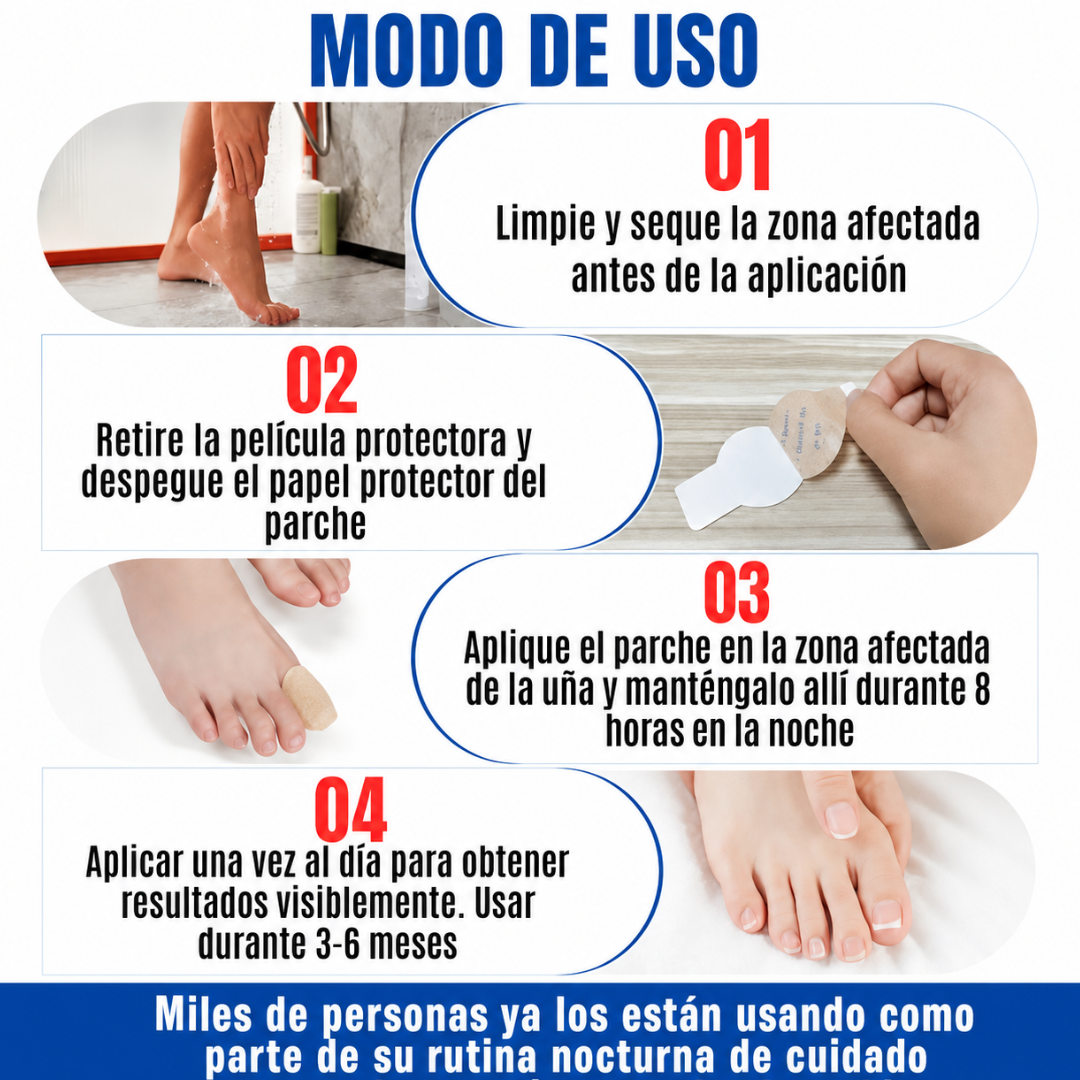 FUNGAL NAIL PATCHES — Elimina el hongo mientras duermes y vuelve a usar sandalias sin pena