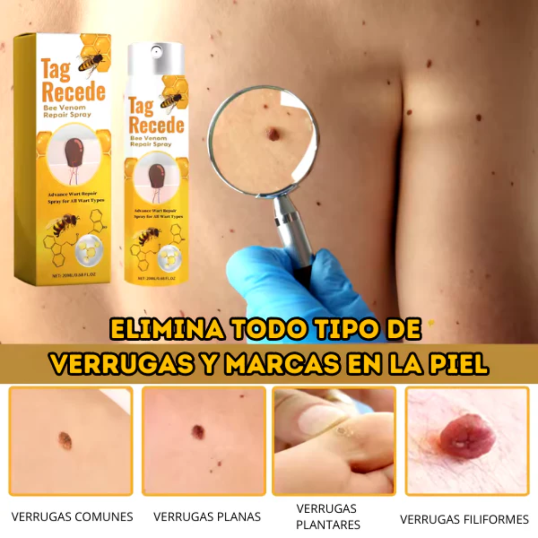 TAG RECEDE VENENO DE ABEJA — Elimina verrugas y etiquetas de piel con veneno de abeja en casa, sin dolor y sin cirugía