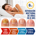 FUNGAL NAIL PATCHES — Elimina el hongo mientras duermes y vuelve a usar sandalias sin pena