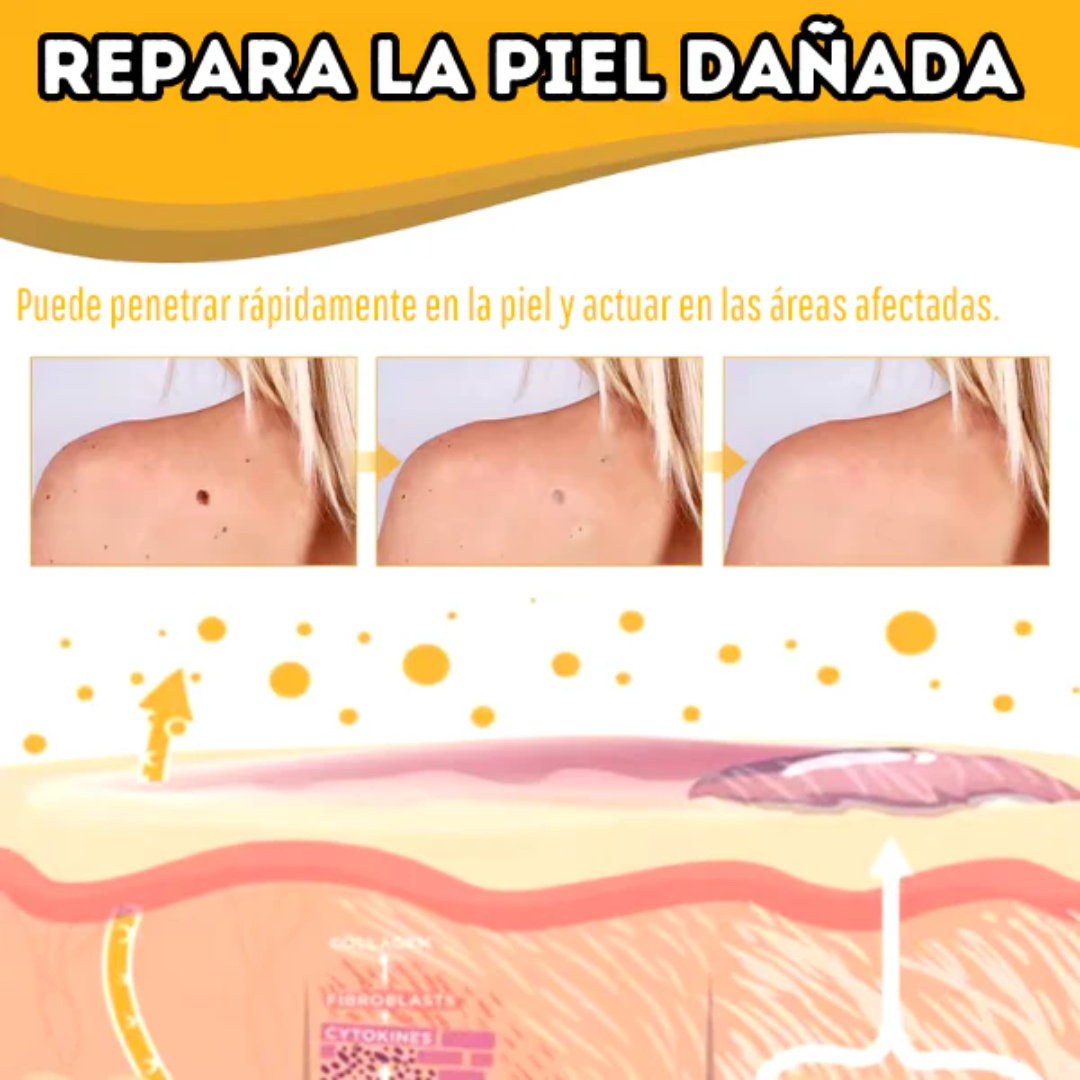 TAG RECEDE VENENO DE ABEJA — Elimina verrugas y etiquetas de piel con veneno de abeja en casa, sin dolor y sin cirugía