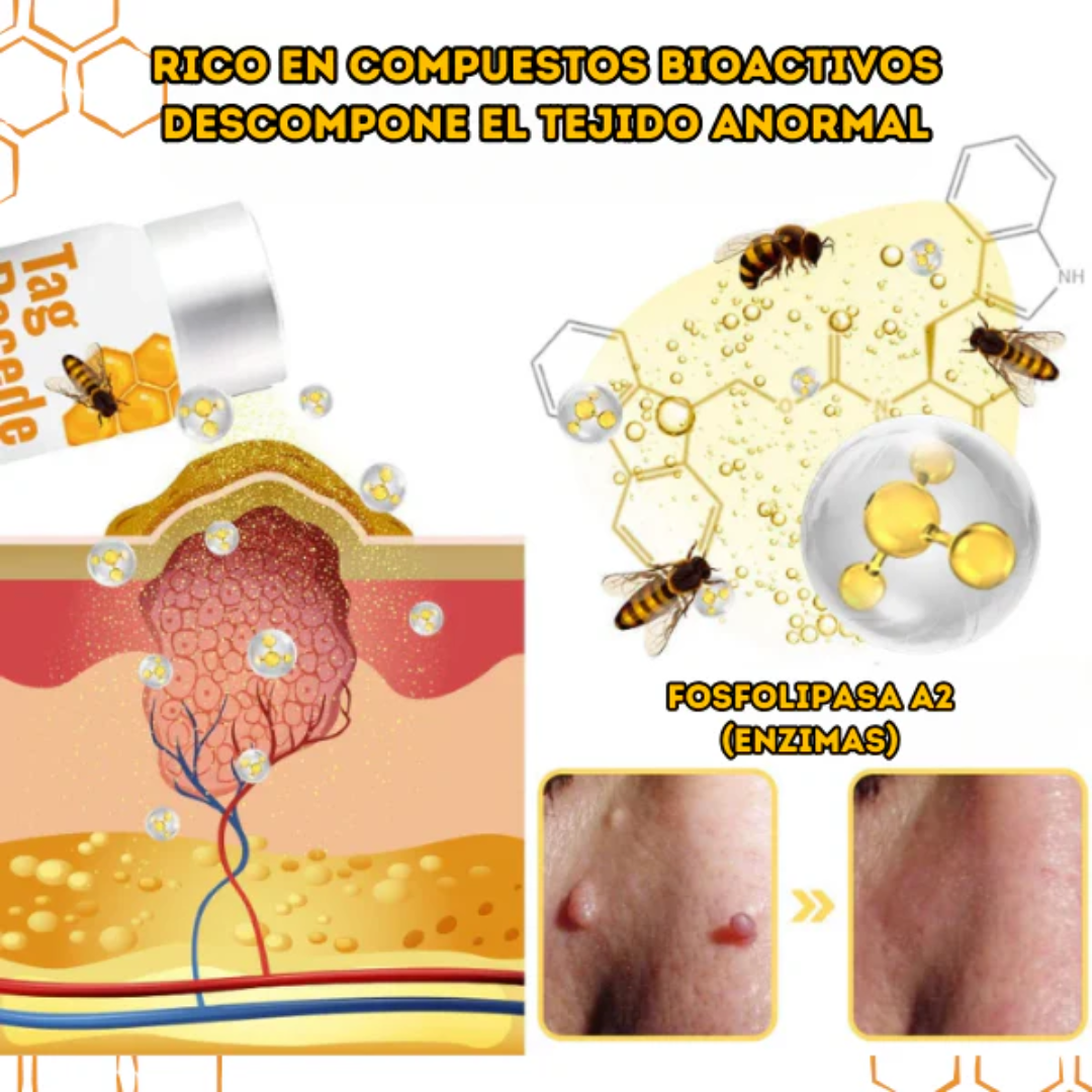 TAG RECEDE VENENO DE ABEJA — Elimina verrugas y etiquetas de piel con veneno de abeja en casa, sin dolor y sin cirugía